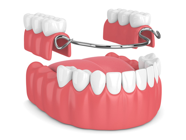 Partial and Complete Dentures at Cramer Dental
